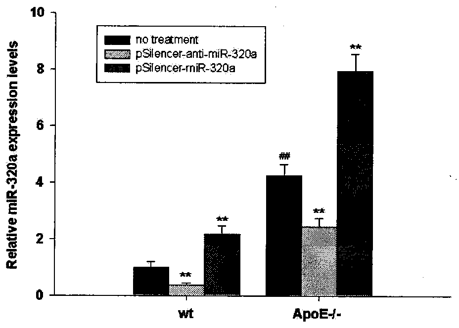 Application of microRNA-320(miR-320a) and its antisense nucleotide in diagnosis, prevention and treatment of cardiovascular diseases