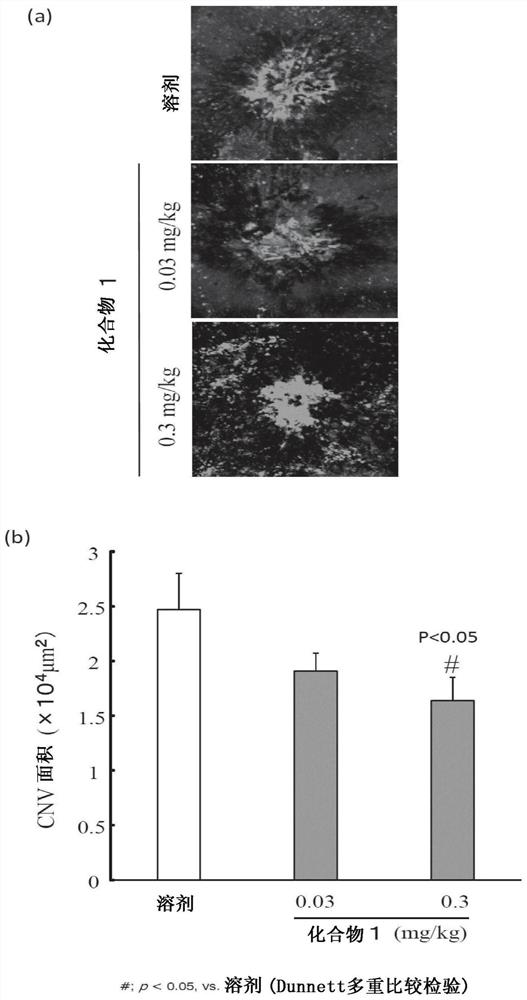 Medicine for preventing or treating ophthalmic disease associated with enhanced intraocular neovascularization and/or intraocular vascular permeability