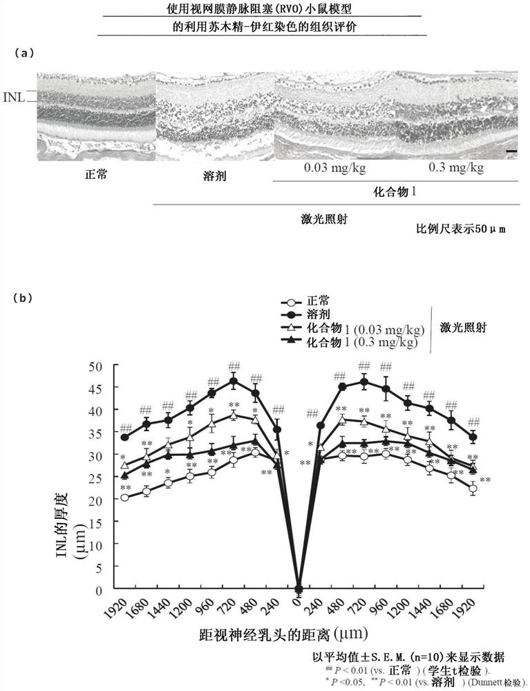 Medicine for preventing or treating ophthalmic disease associated with enhanced intraocular neovascularization and/or intraocular vascular permeability