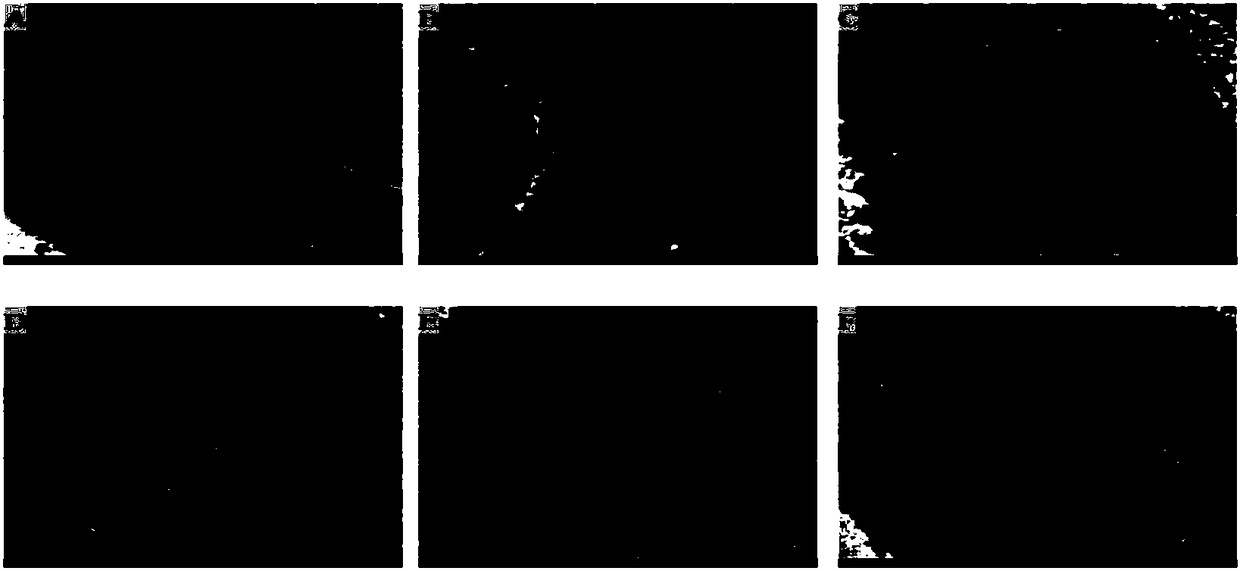 Application of acanthopanax senticosus extract in preparing medicine for preventing or treating cardiac toxicity