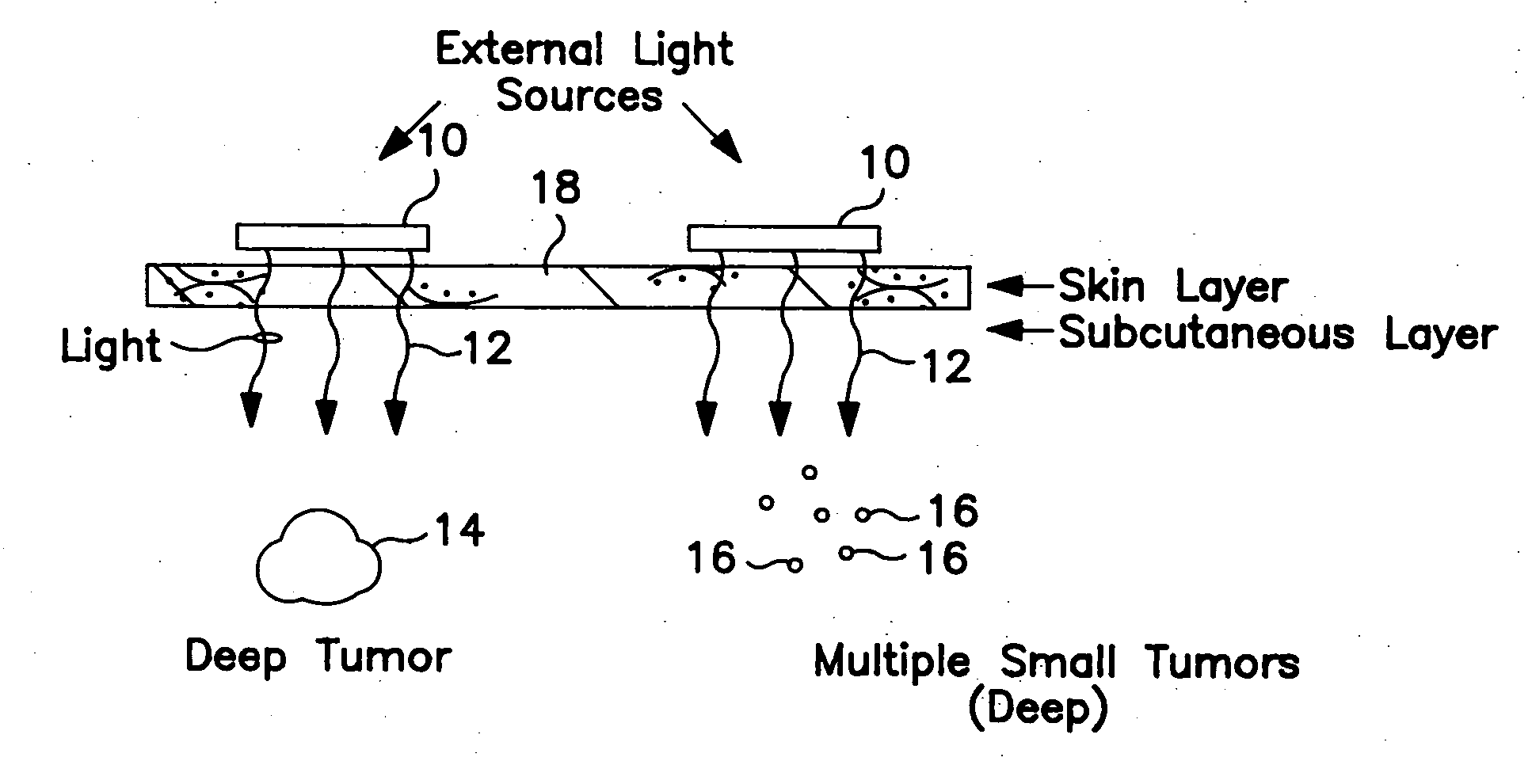 Photodynamic treatment of targeted cells