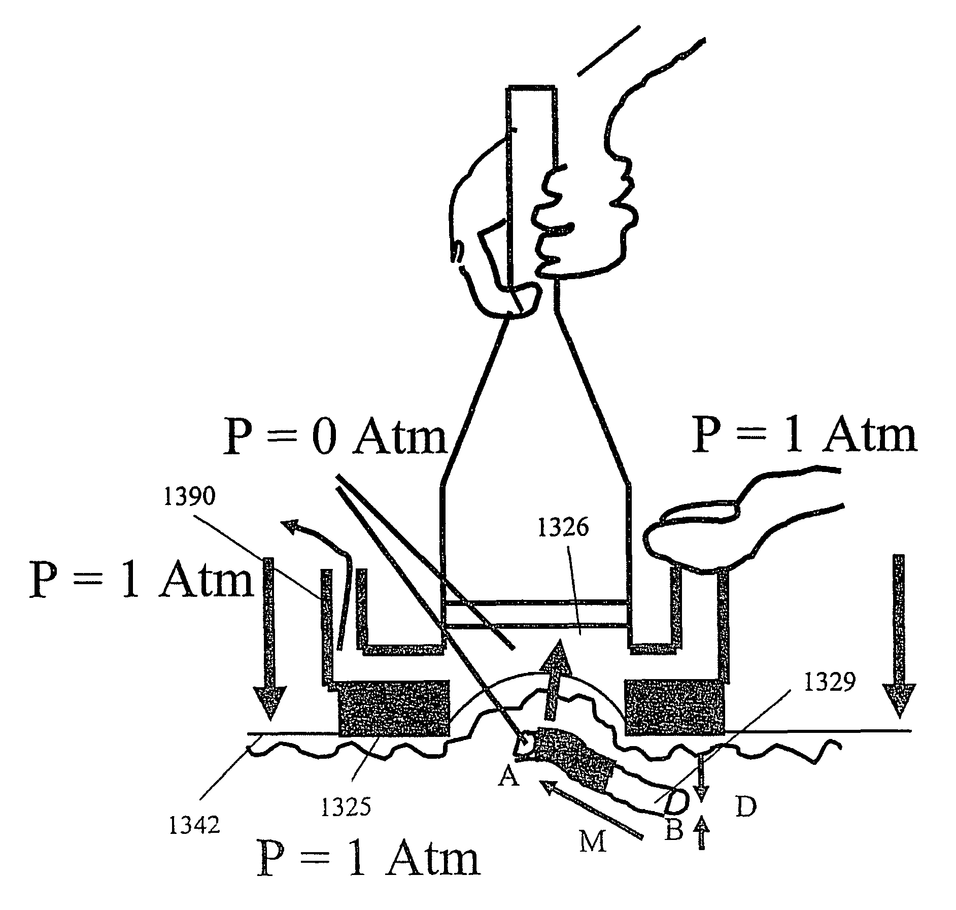 Method and apparatus for vacuum-assisted light-based treatments of the skin