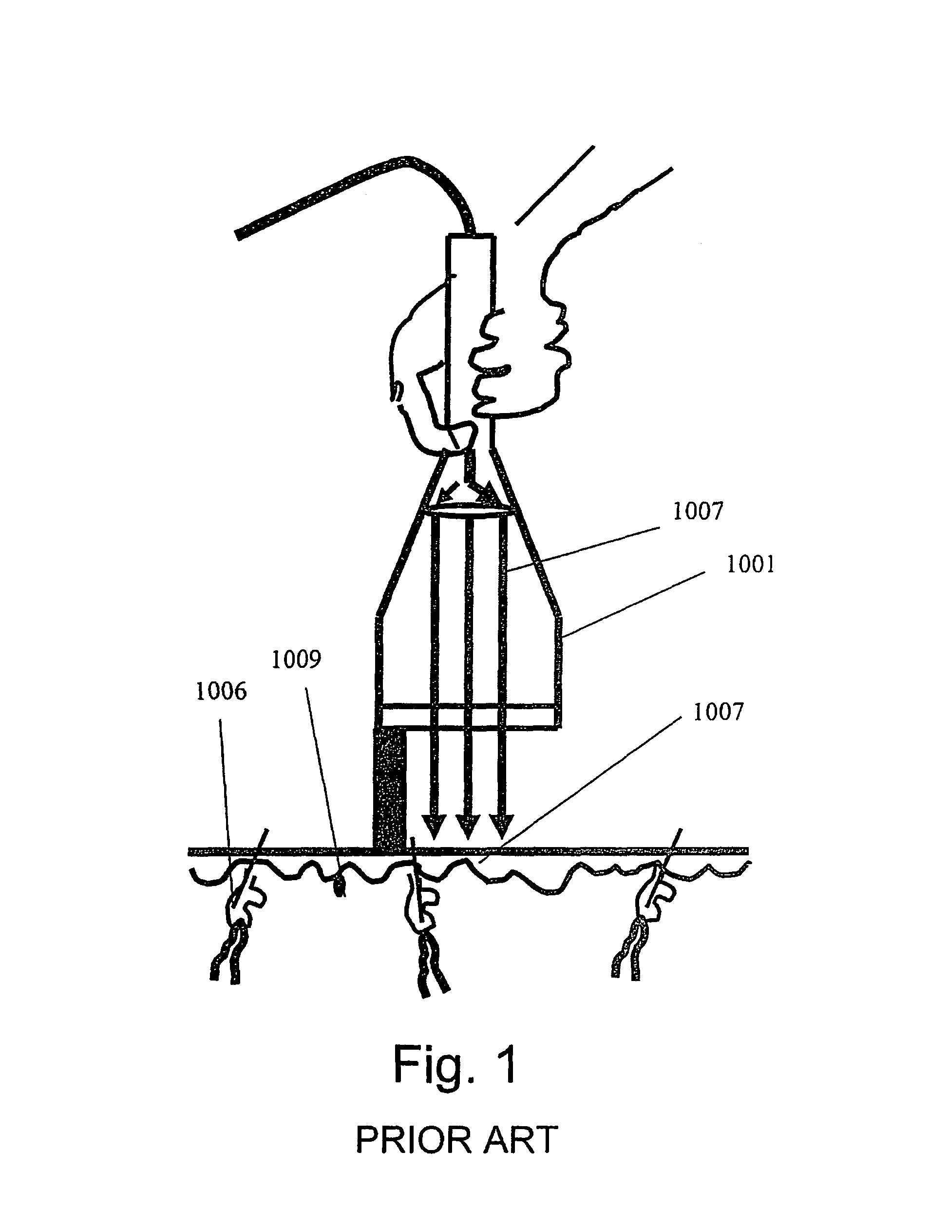 Method and apparatus for vacuum-assisted light-based treatments of the skin