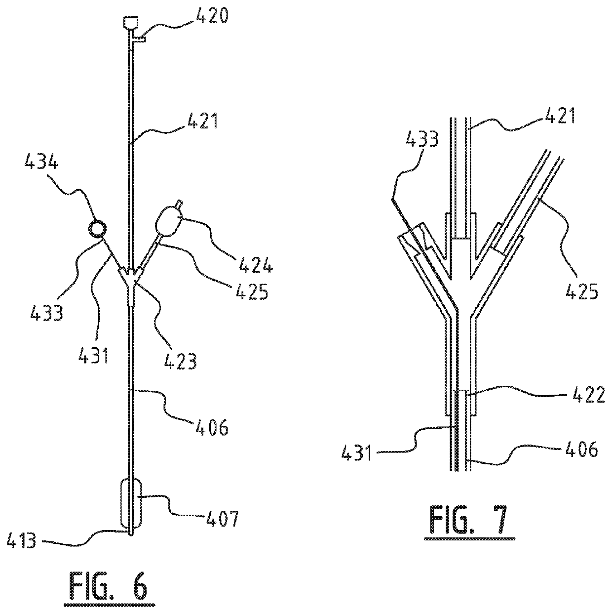 System with an inflatable member for being arranged in the patient's respiratory tract