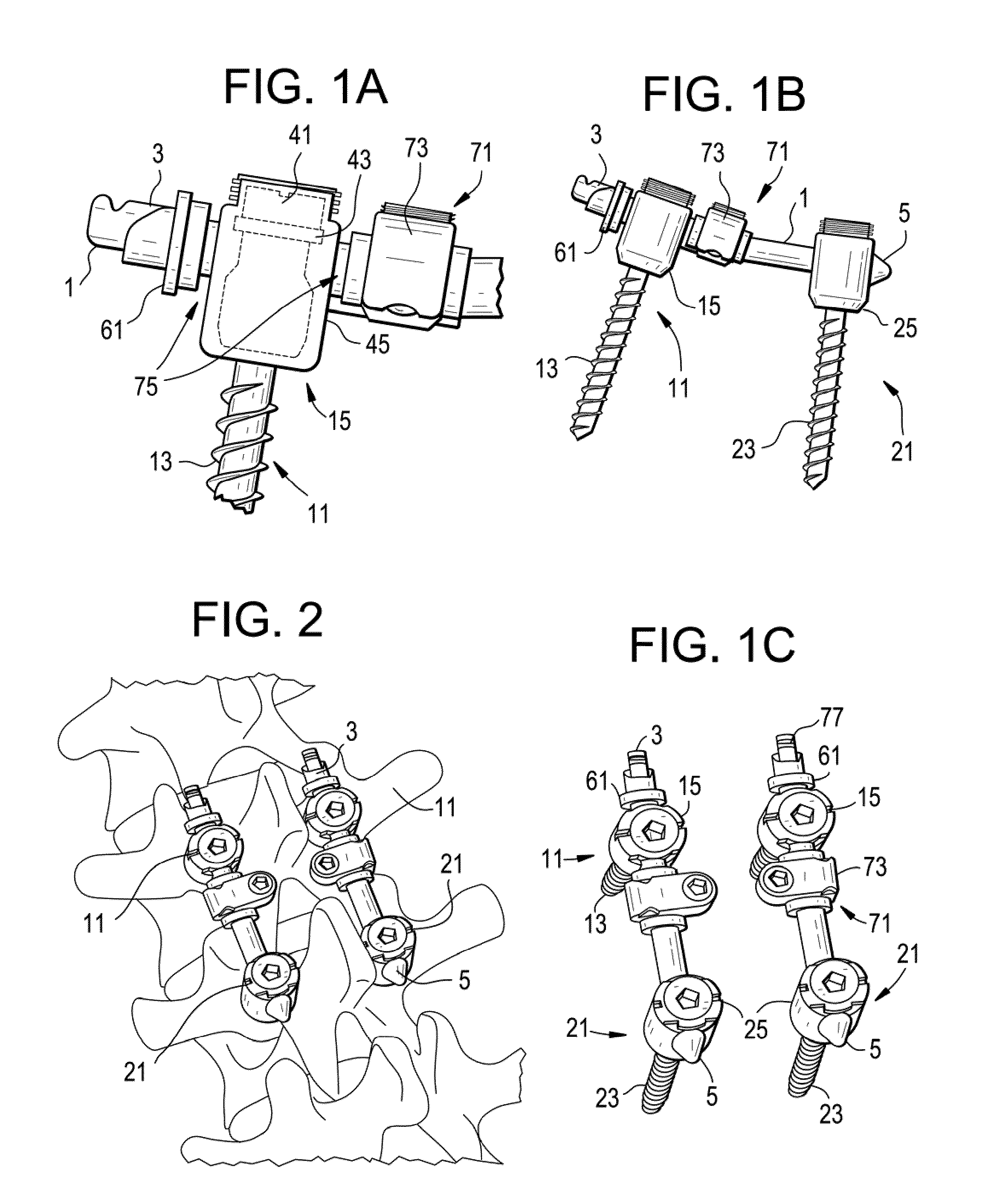 Posterior Dynamic Stabilization Device Having A Mobile Anchor