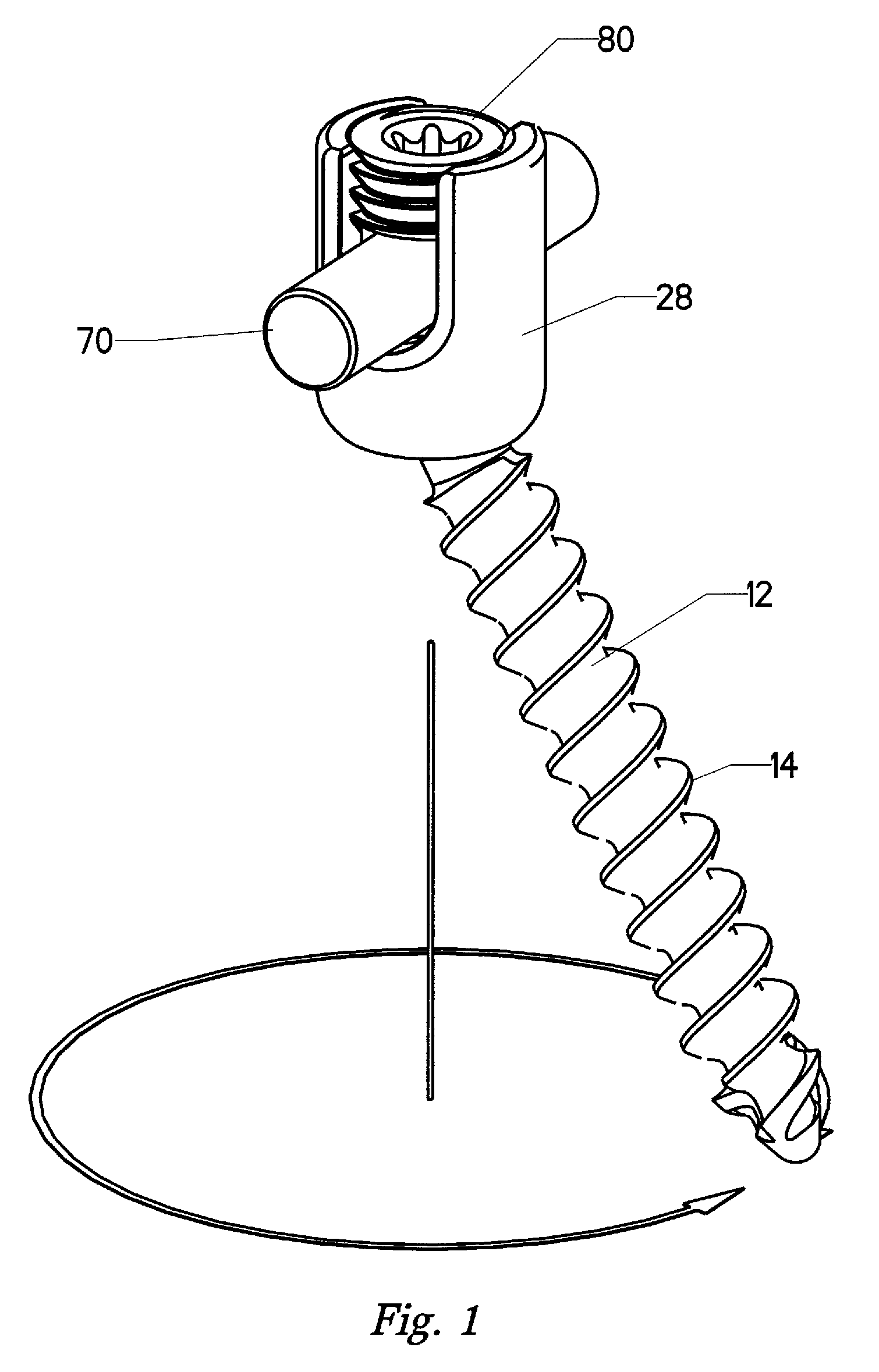 Spring clip bottom loading polyaxial ball and socket fastener