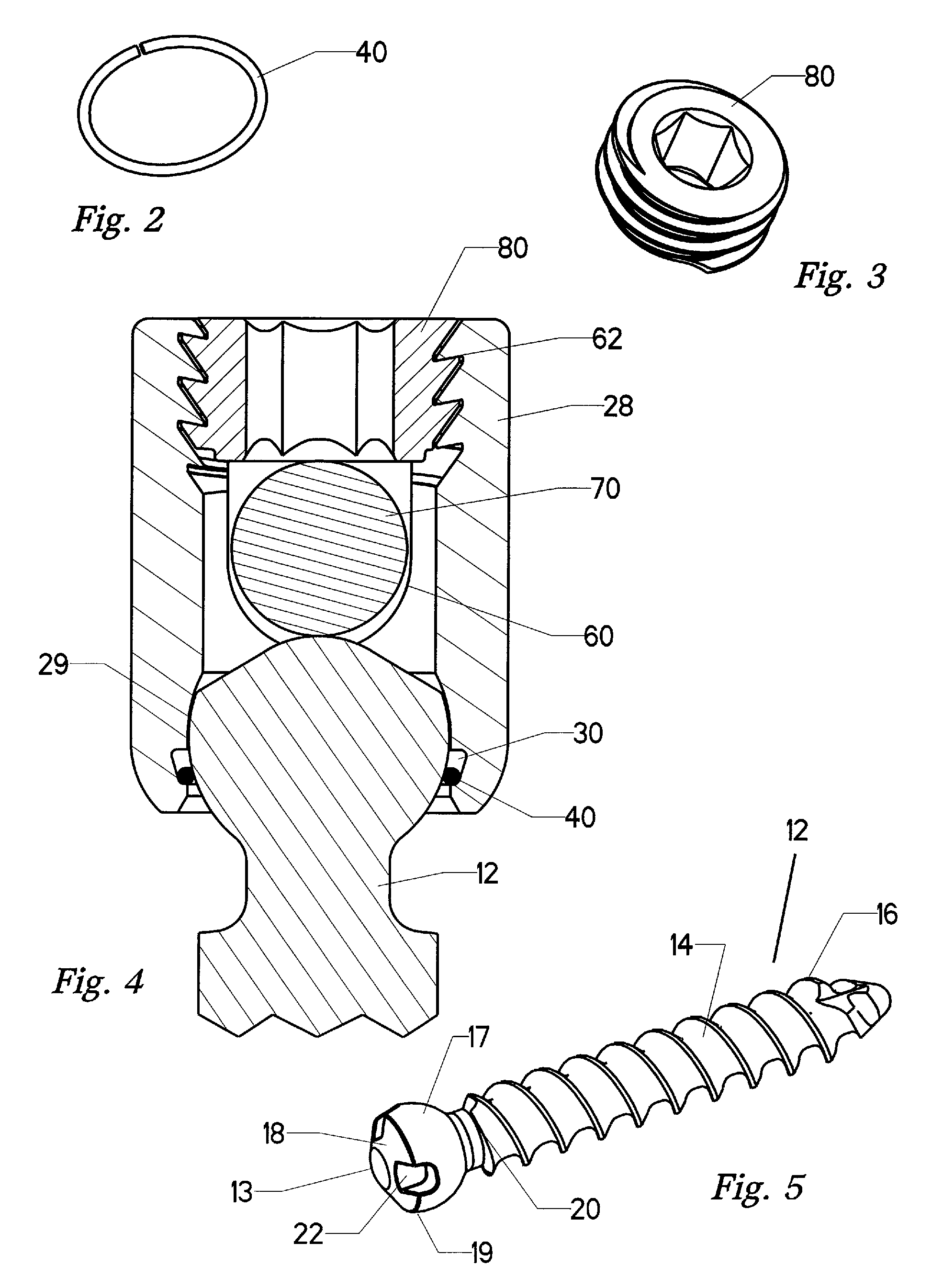 Spring clip bottom loading polyaxial ball and socket fastener