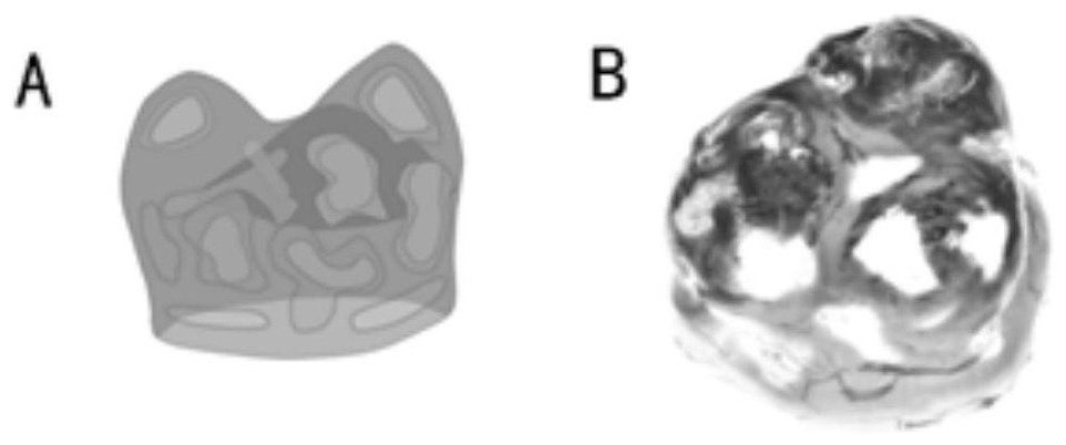 Anti-fatigue all-hydrogel composite material as well as preparation method and application thereof