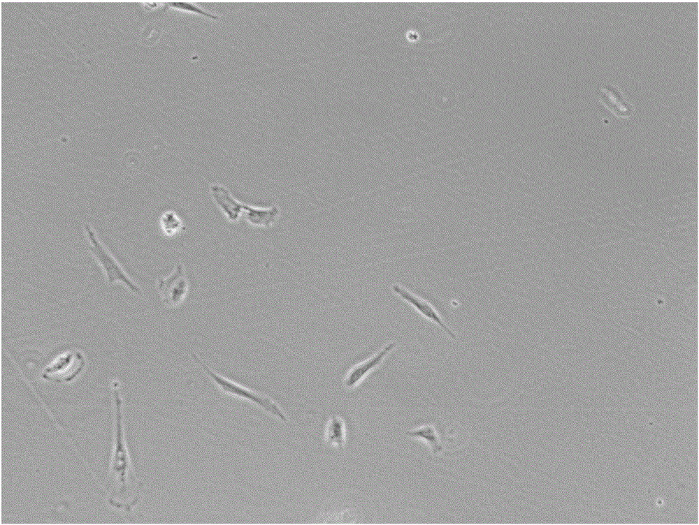 Method for preparing amniotic mesenchymal stem cells from human placenta amnion and application of amniotic mesenchymal stem cells