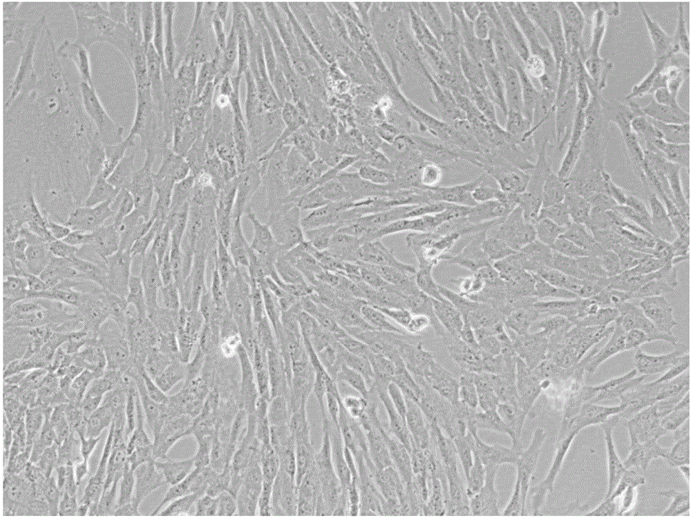 Method for preparing amniotic mesenchymal stem cells from human placenta amnion and application of amniotic mesenchymal stem cells