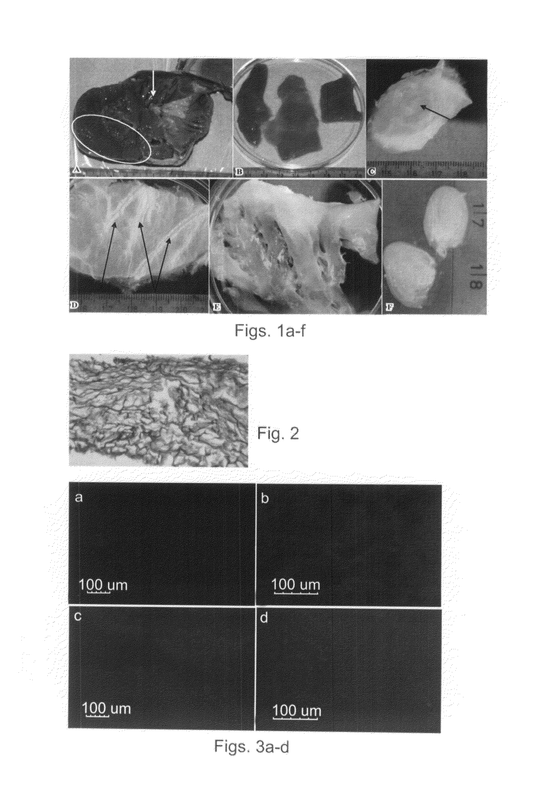 Natural Tissue-Derived Decellularized Matrix and Methods of Generating and Using Same