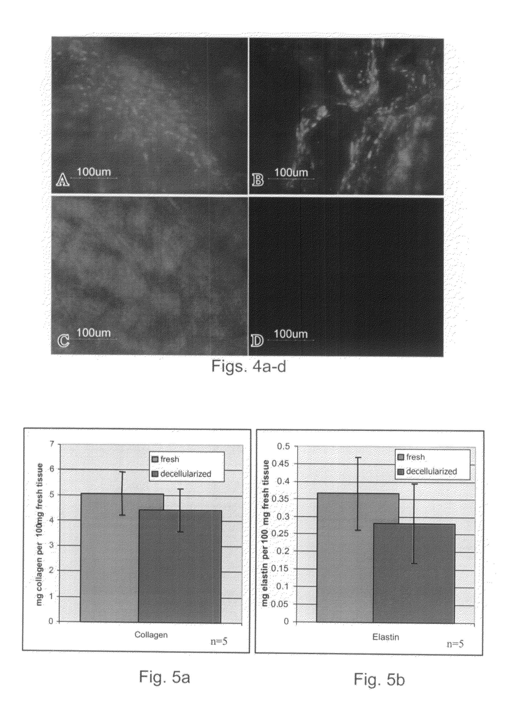 Natural Tissue-Derived Decellularized Matrix and Methods of Generating and Using Same