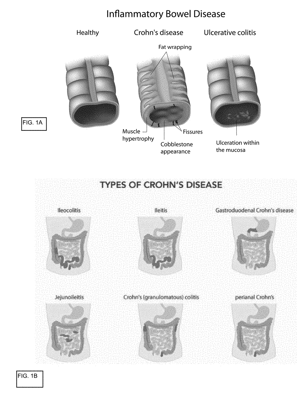 In vitro gastrointestinal model comprising lamina propria-derived cells