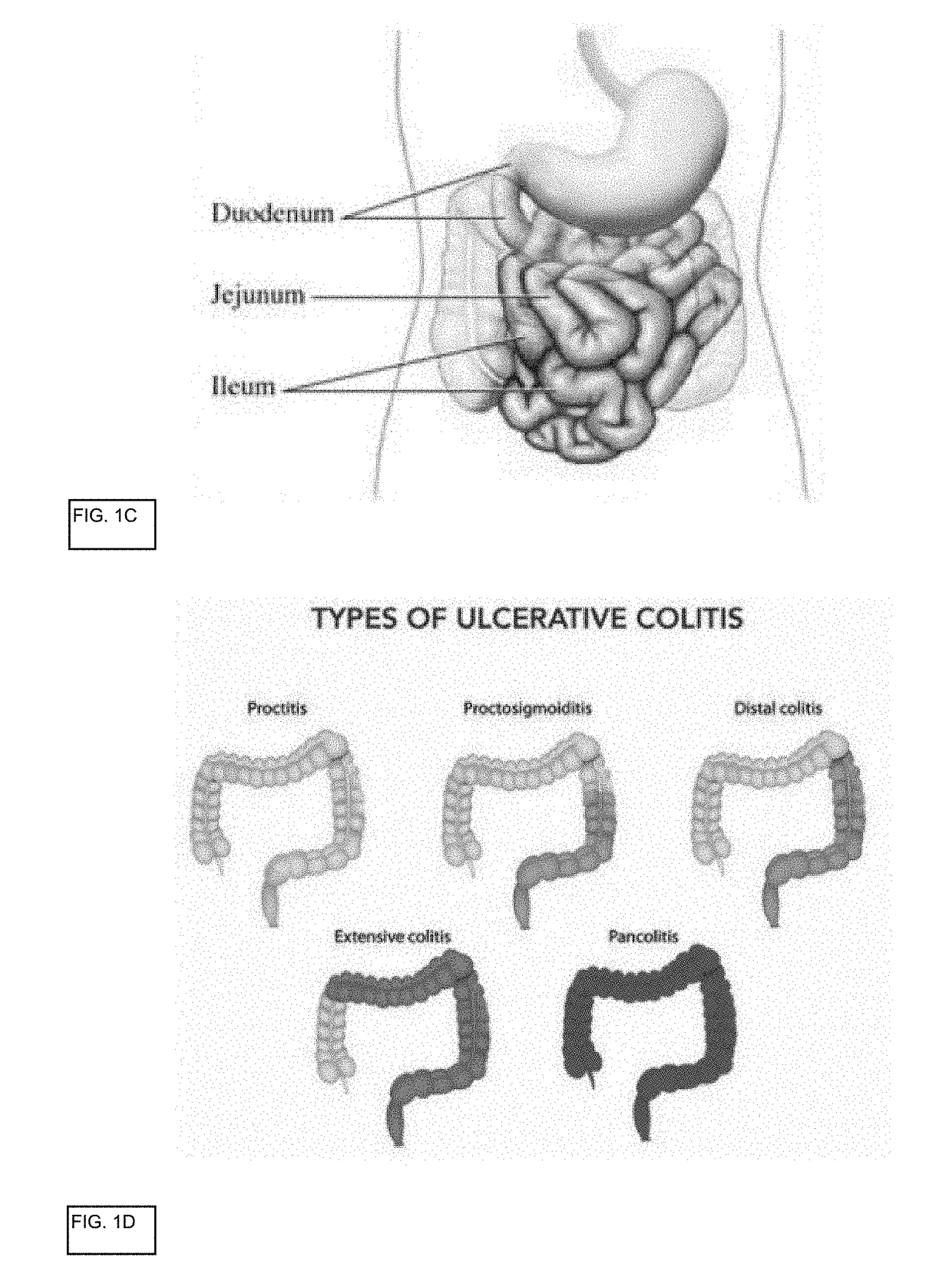 In vitro gastrointestinal model comprising lamina propria-derived cells