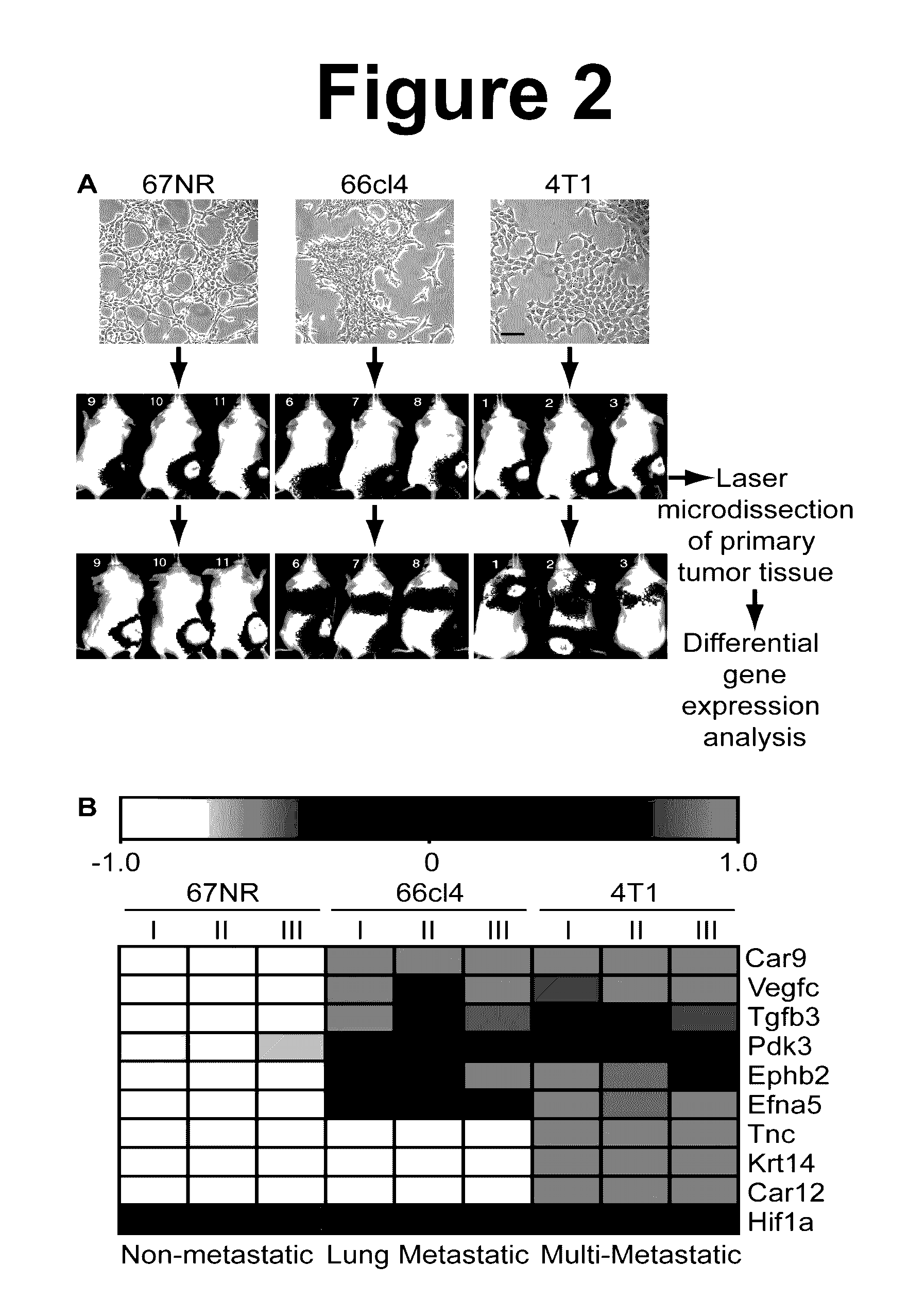 Sulfonamide compounds for inhibition of metastatic tumor growth