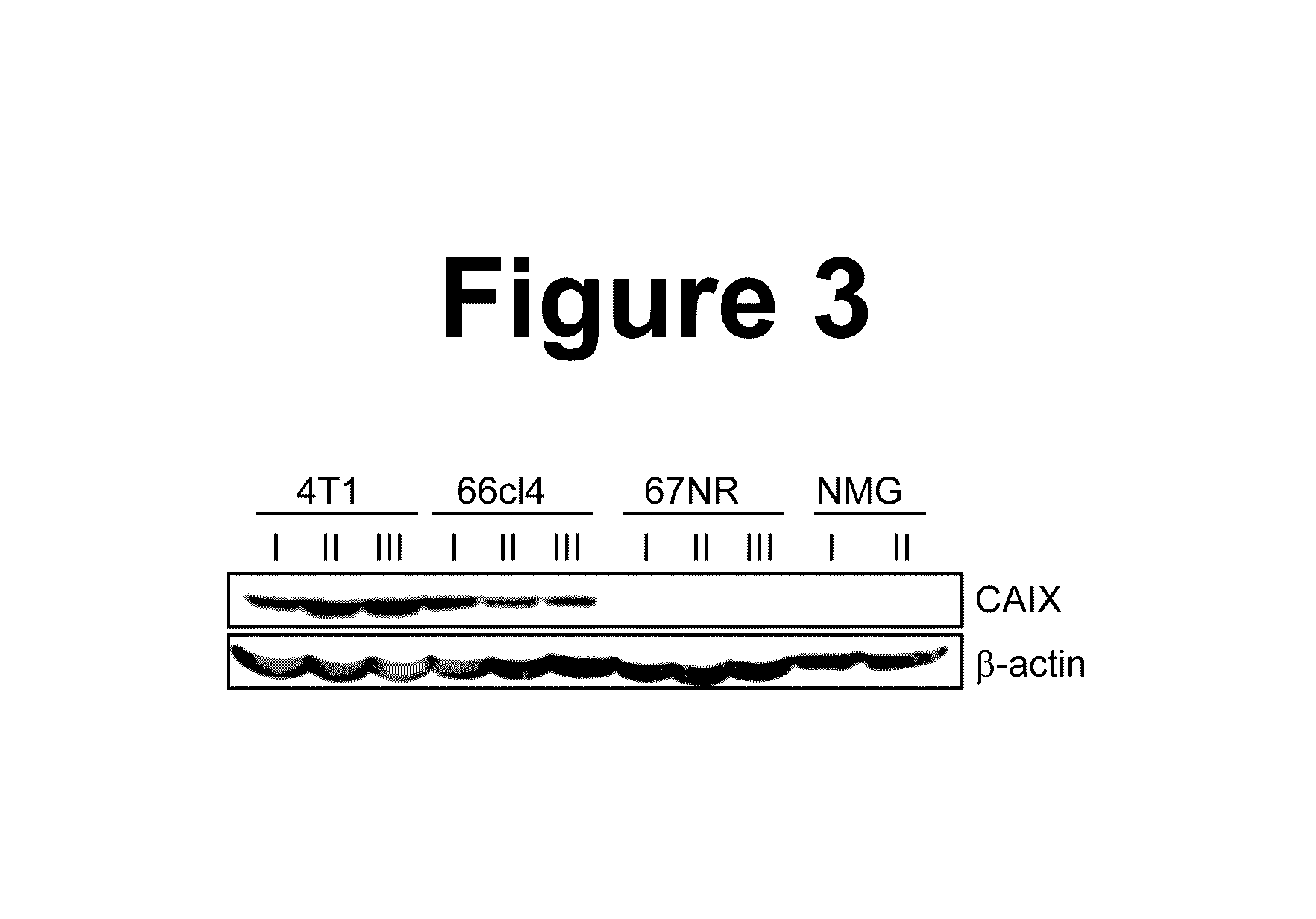 Sulfonamide compounds for inhibition of metastatic tumor growth