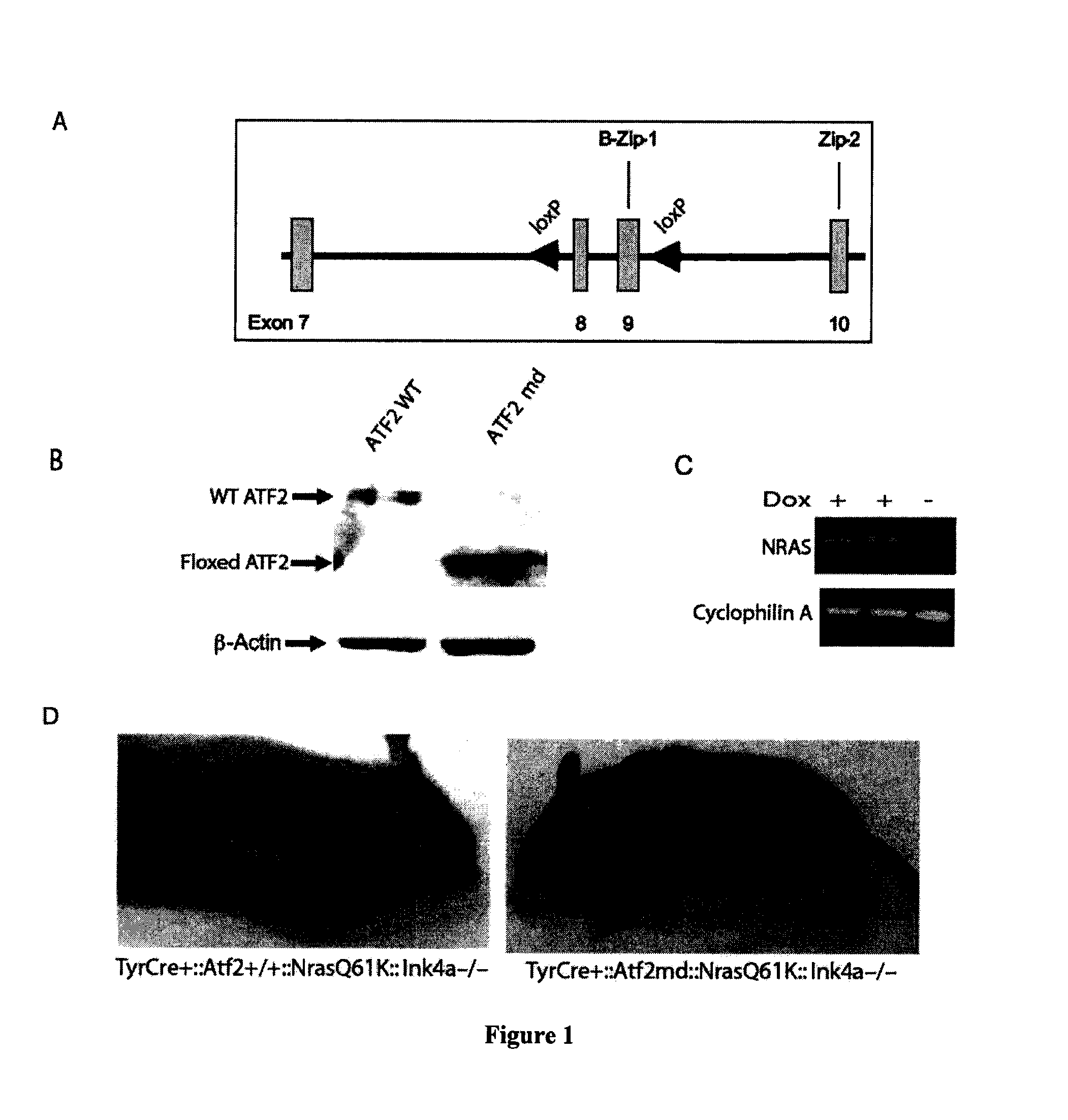 Methods of diagnosis and treatment of melanoma