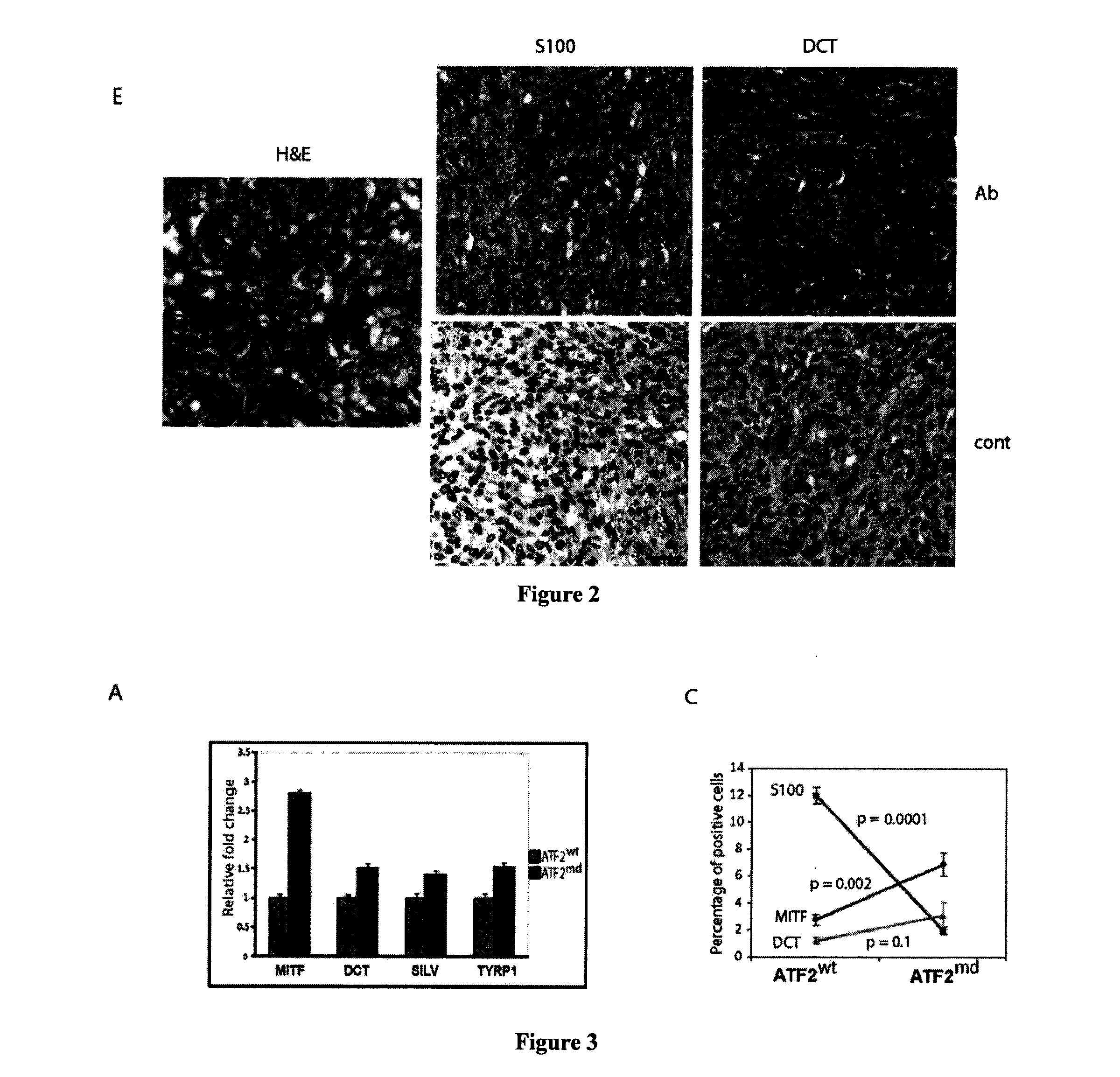 Methods of diagnosis and treatment of melanoma