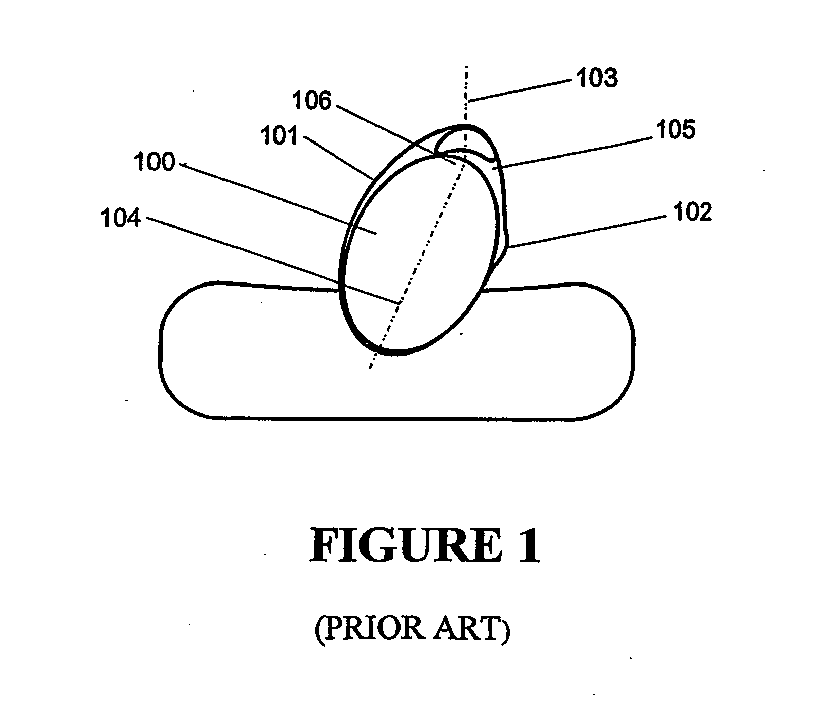 Nasal masks