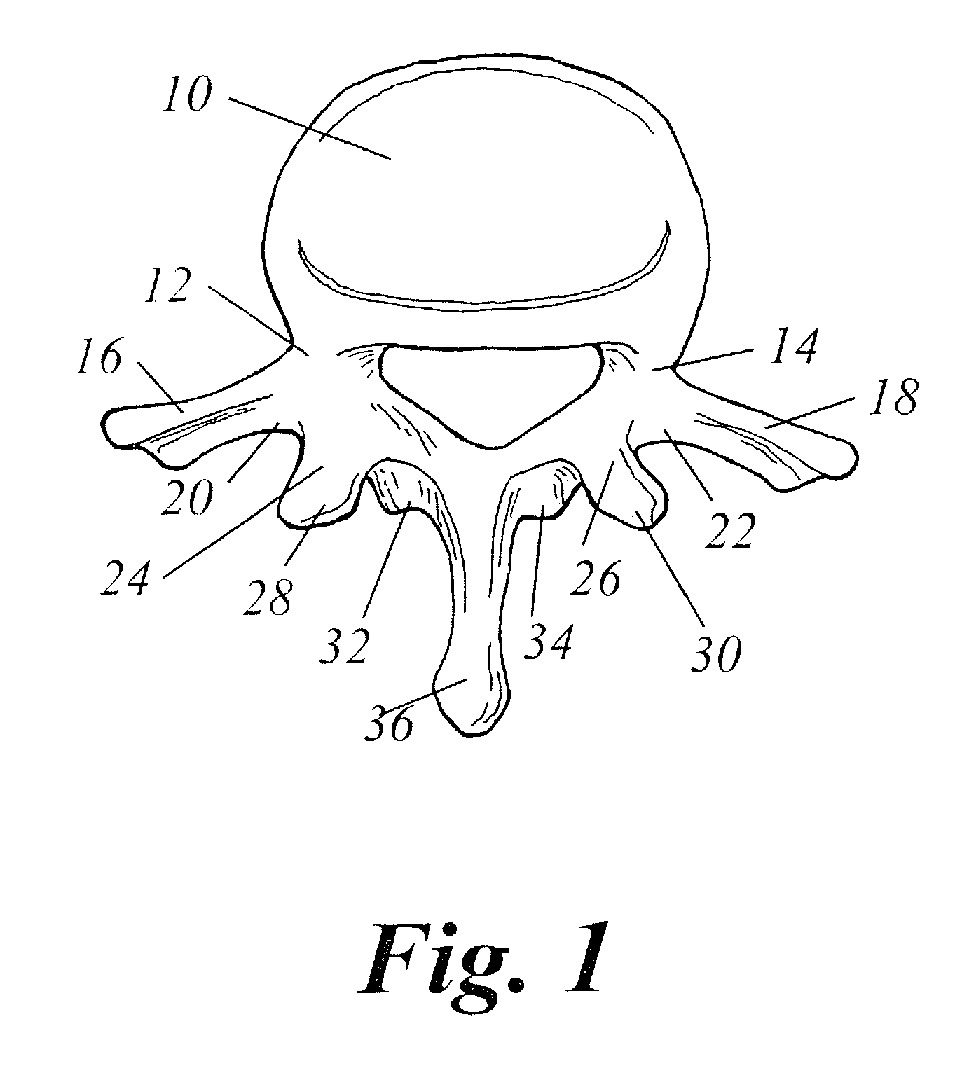 Spinal fusion using an HMG-CoA reductase inhibitor