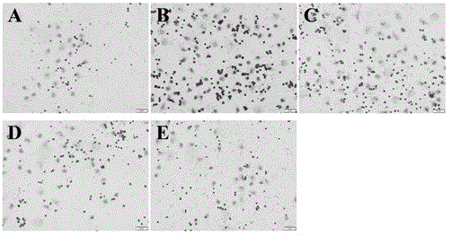 Application of salidroside in preparation of medicine for treating gouty arthritis