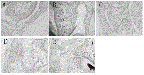 Application of salidroside in preparation of medicine for treating gouty arthritis