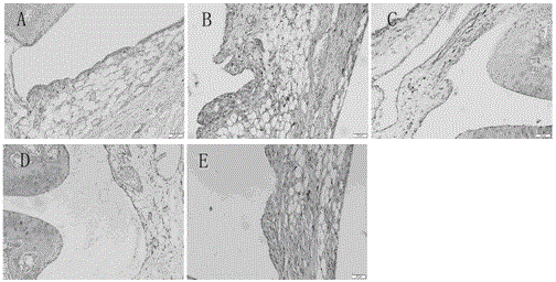 Application of salidroside in preparation of medicine for treating gouty arthritis