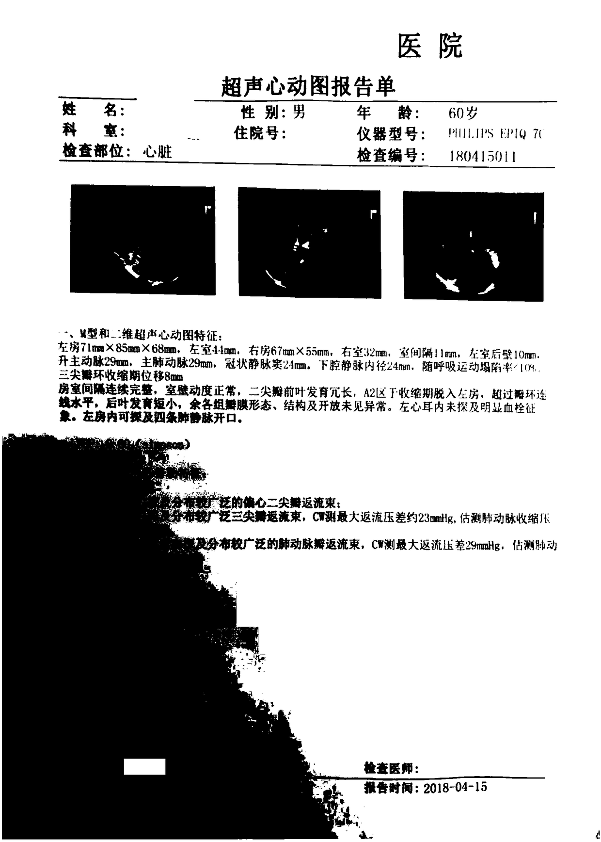 Intelligent evaluation and diagnosis method and system for heart disease types and severity degrees