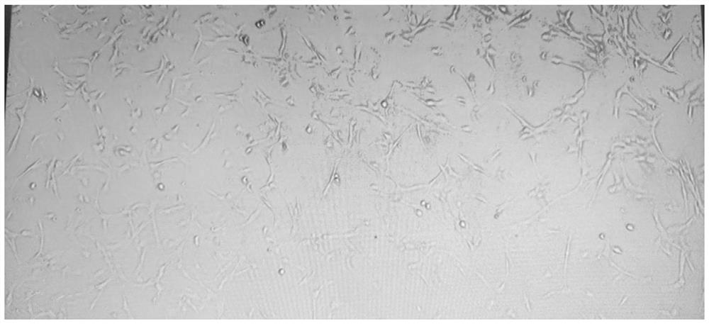 Method for separating and extracting cryopreserved adipose-derived stem cells from adipose