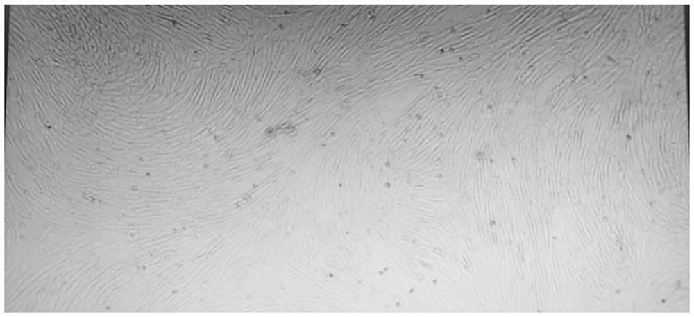 Method for separating and extracting cryopreserved adipose-derived stem cells from adipose