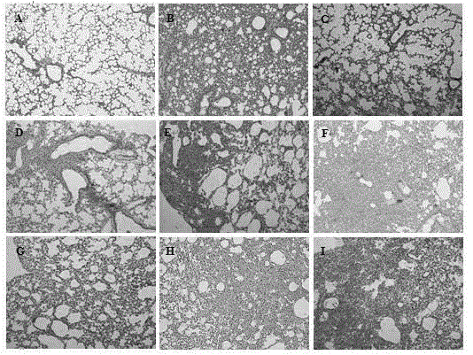 Application of traditional Chinese medicine composition in preparation of drug used for resisting influenza A (H3N2) virus