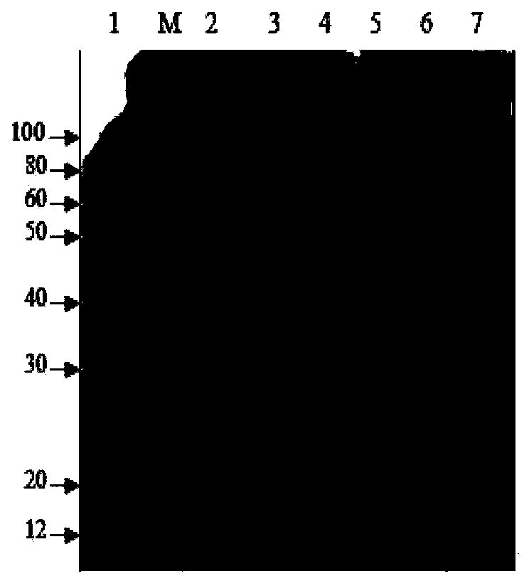 Preparation of serologic H-Y antigen gene DBY antibody and XY sperm immune sorting method thereof