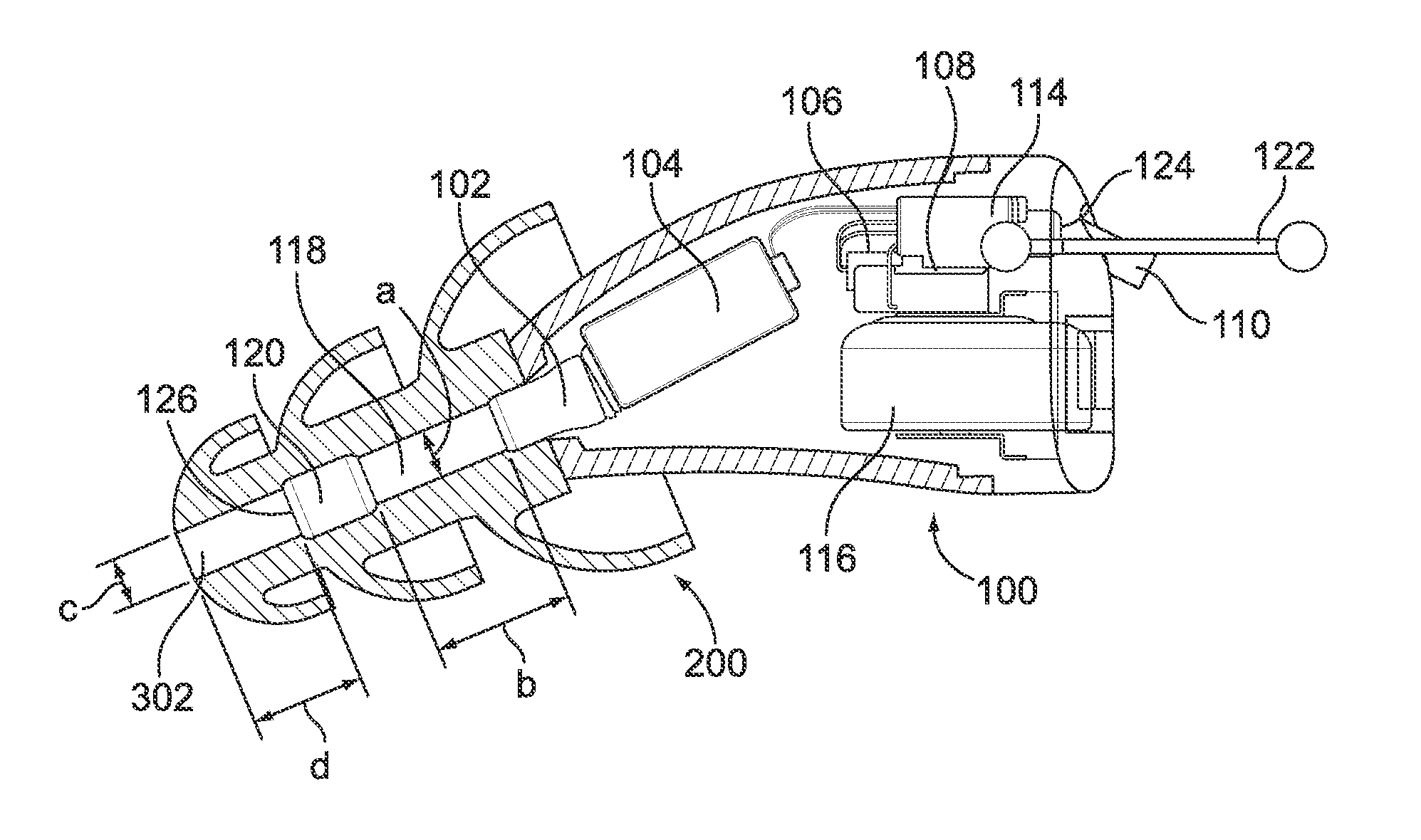 Electronic earplug