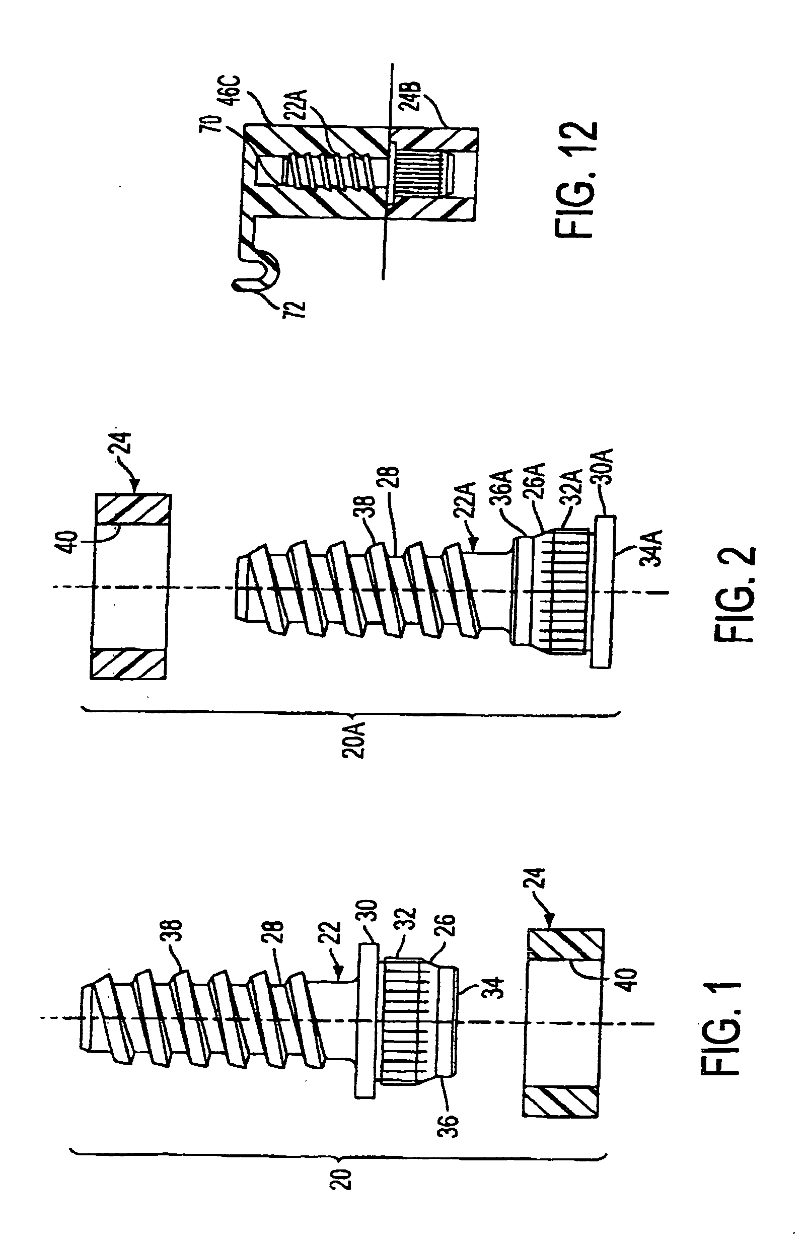 Quick assembly fastening system for plastic parts