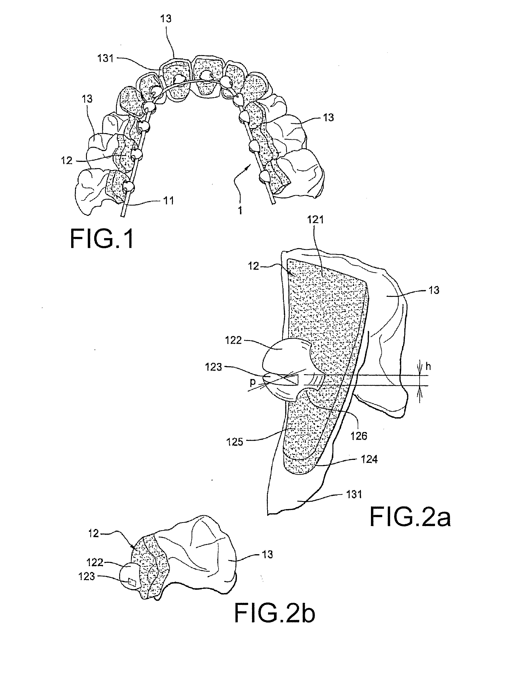 Method for Producing a Customized Orthodontic Appliance