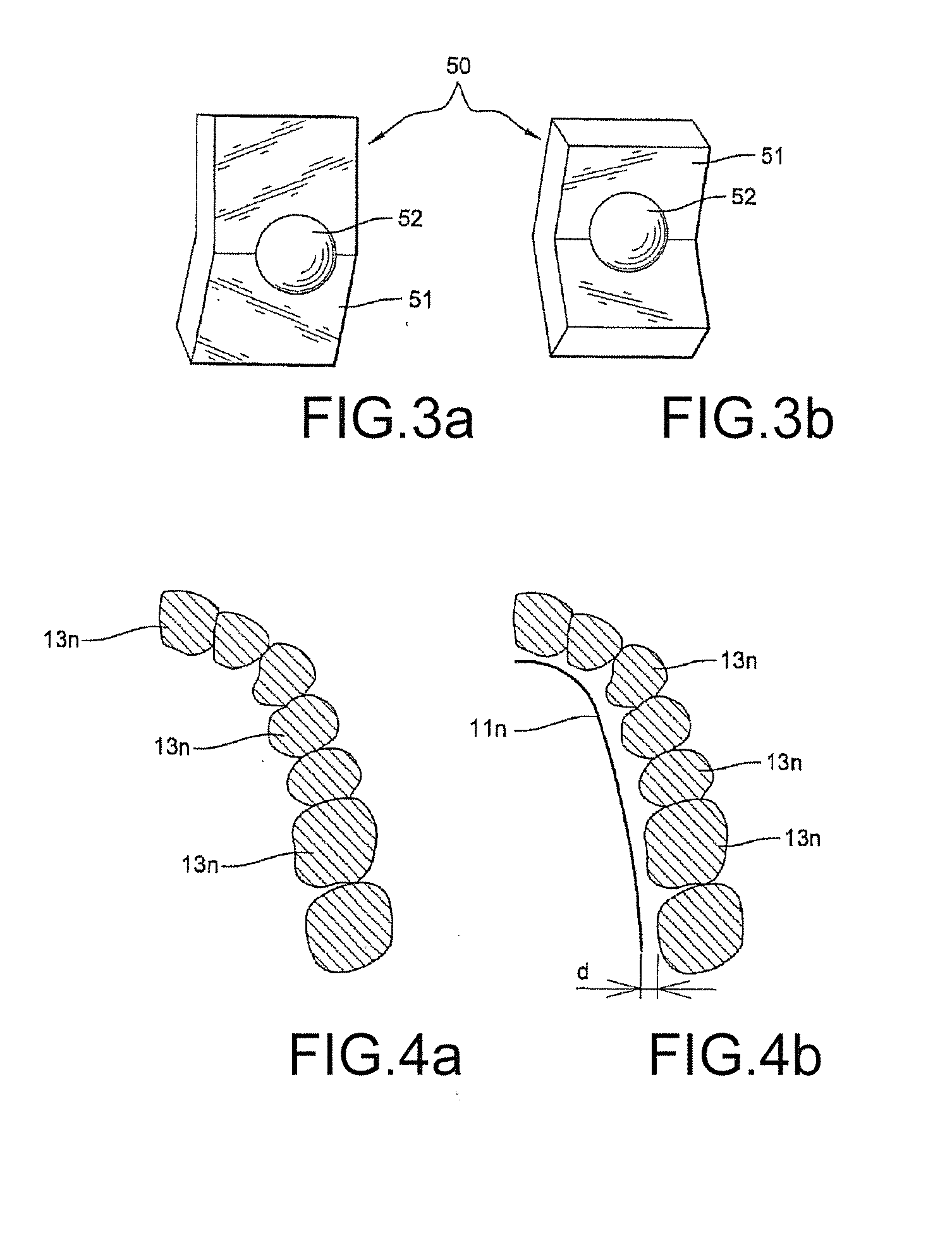 Method for Producing a Customized Orthodontic Appliance