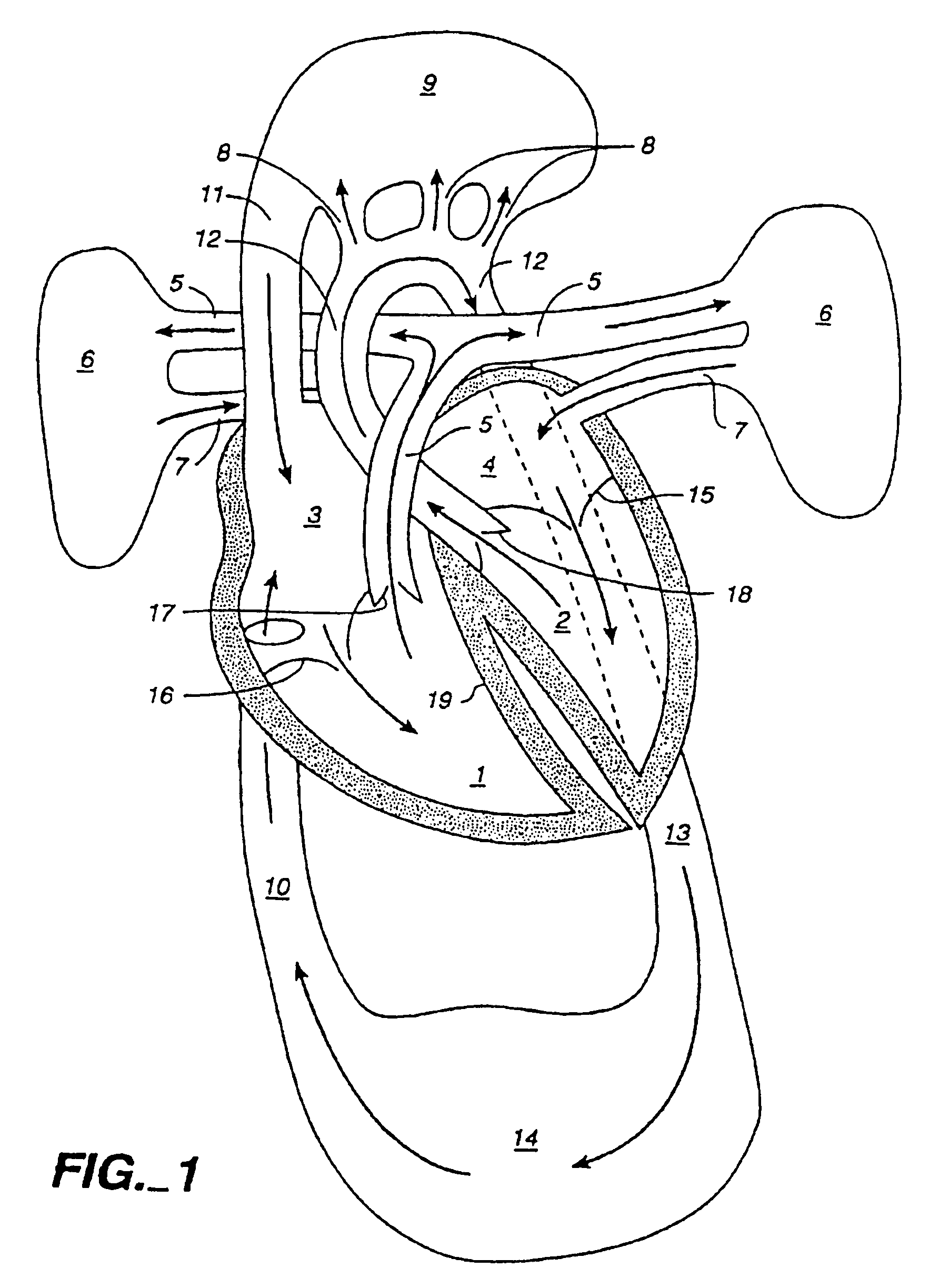 Multichannel catheter