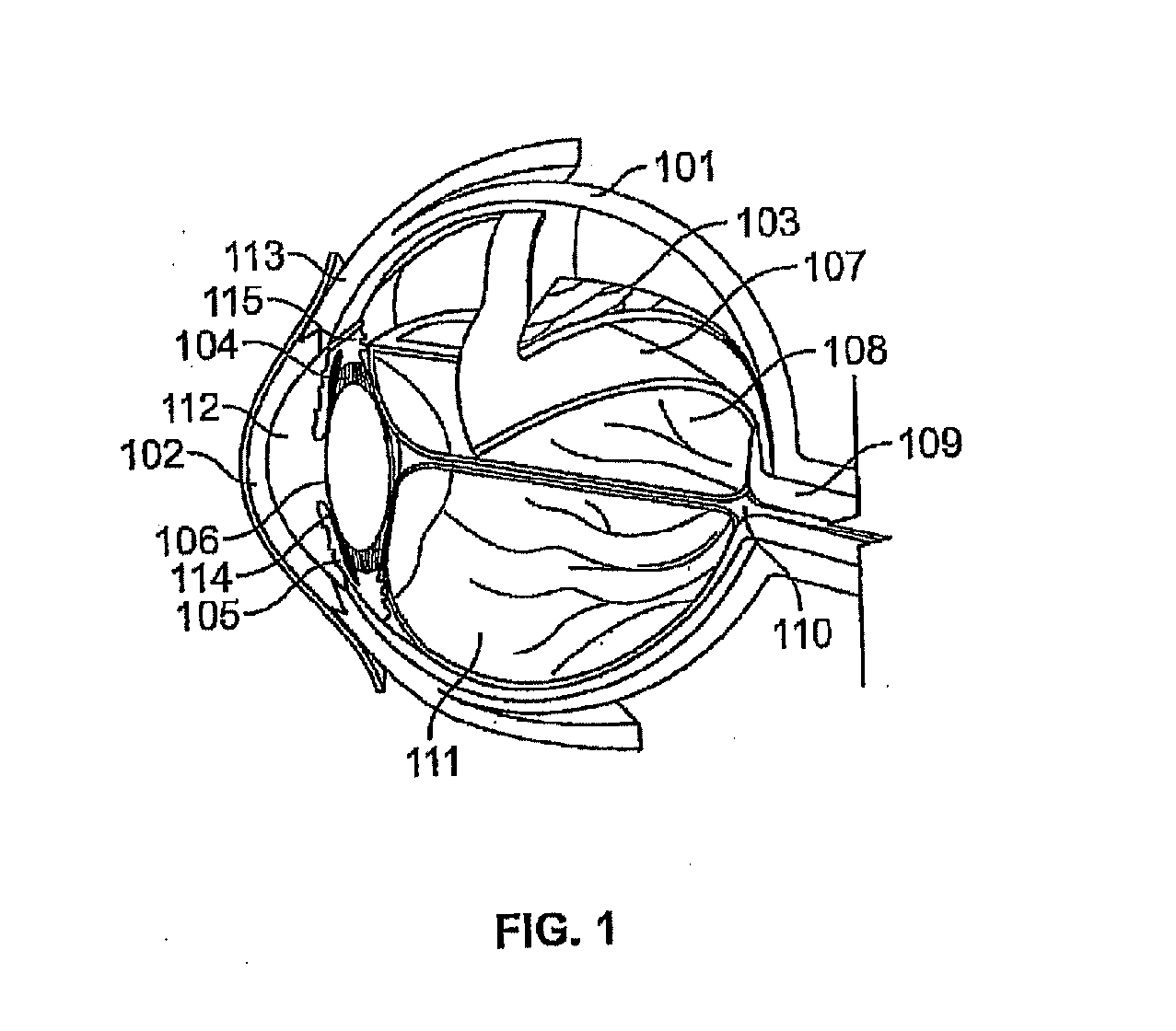 Processes and apparatus for preventing, delaying or ameliorating one or more symptoms of presbyopia