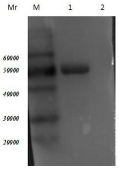 Trichinella spiralis 7tr protein human single-chain antibody, preparation method and medical application