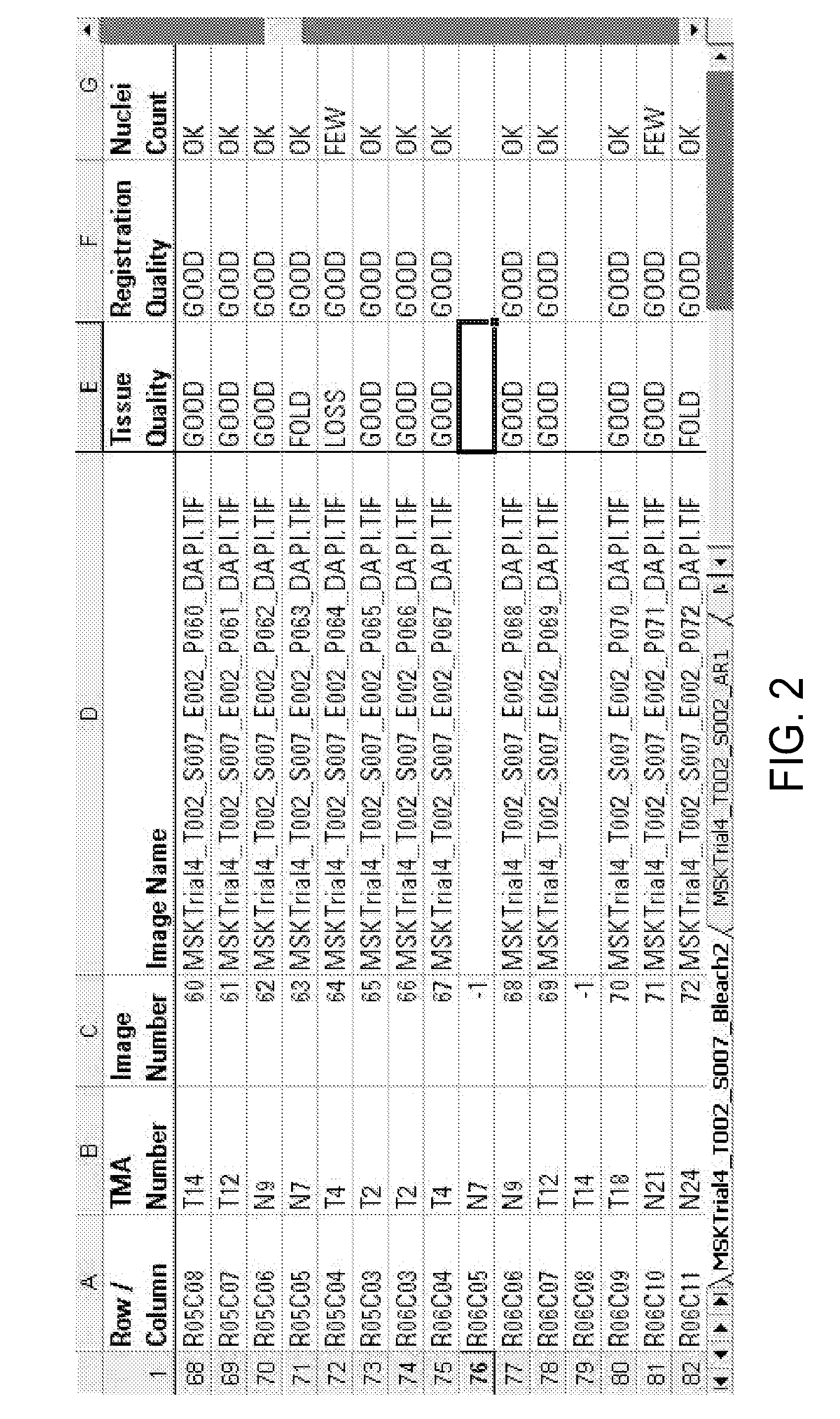 Method and Apparatus for Detecting Irregularities in Tissue Microarrays