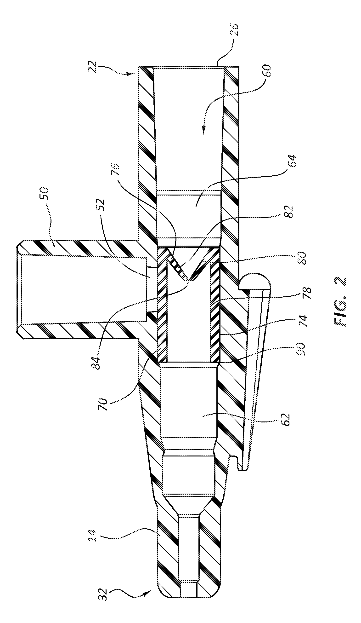 Intravenous catheter with duckbill valve