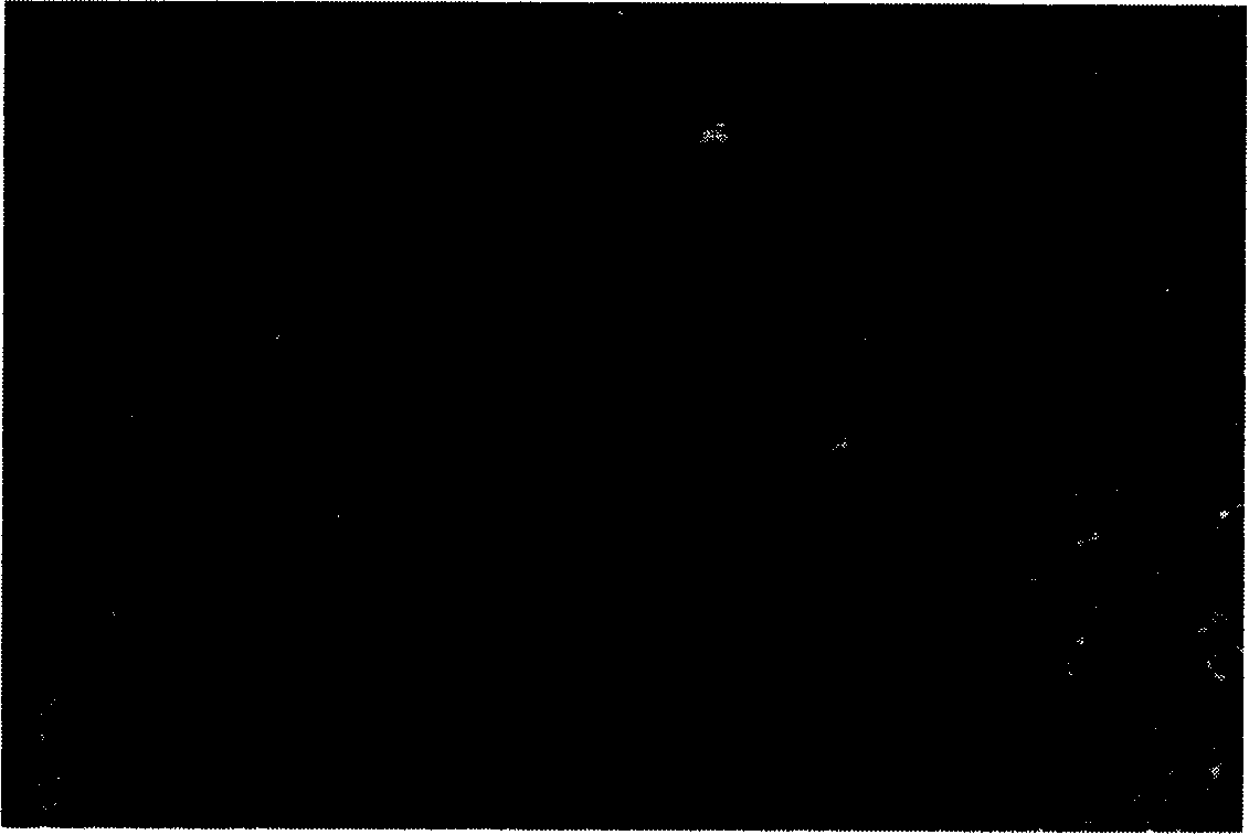 Herpes simplex virus and recombinant virus as well as host cell and medicinal combination thereof