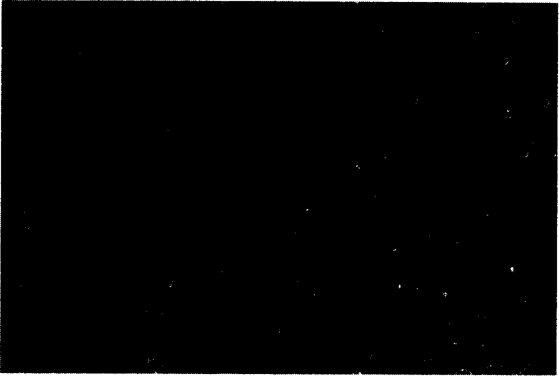 Herpes simplex virus and recombinant virus as well as host cell and medicinal combination thereof