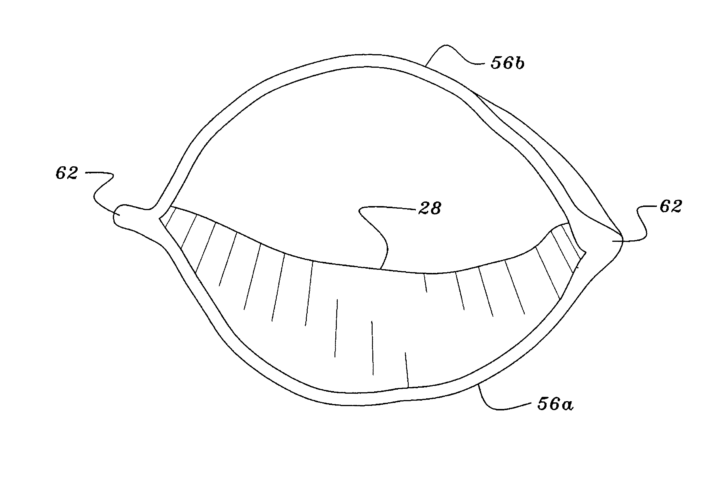 Bicuspid vascular valve and methods for making and implanting same