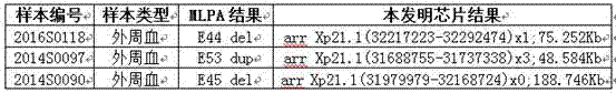 Duchenne muscular dystrophy (DMD) detection gene chip and kit and use method of kit