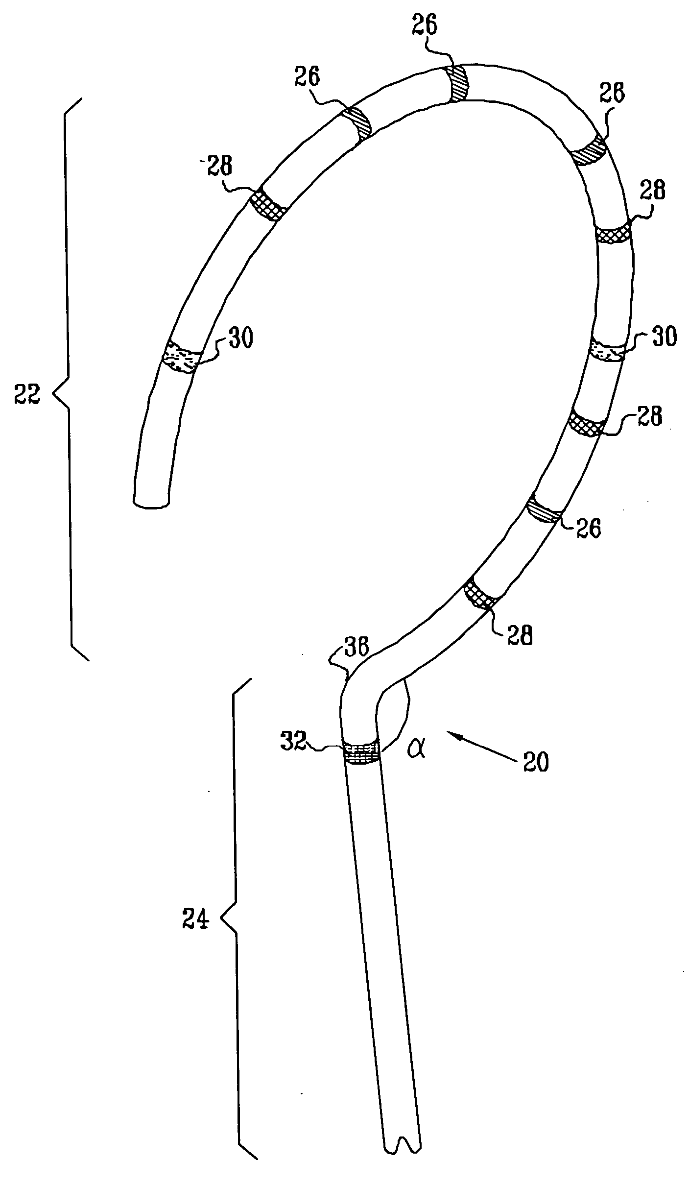 Lasso for pulmonary vein mapping and ablation