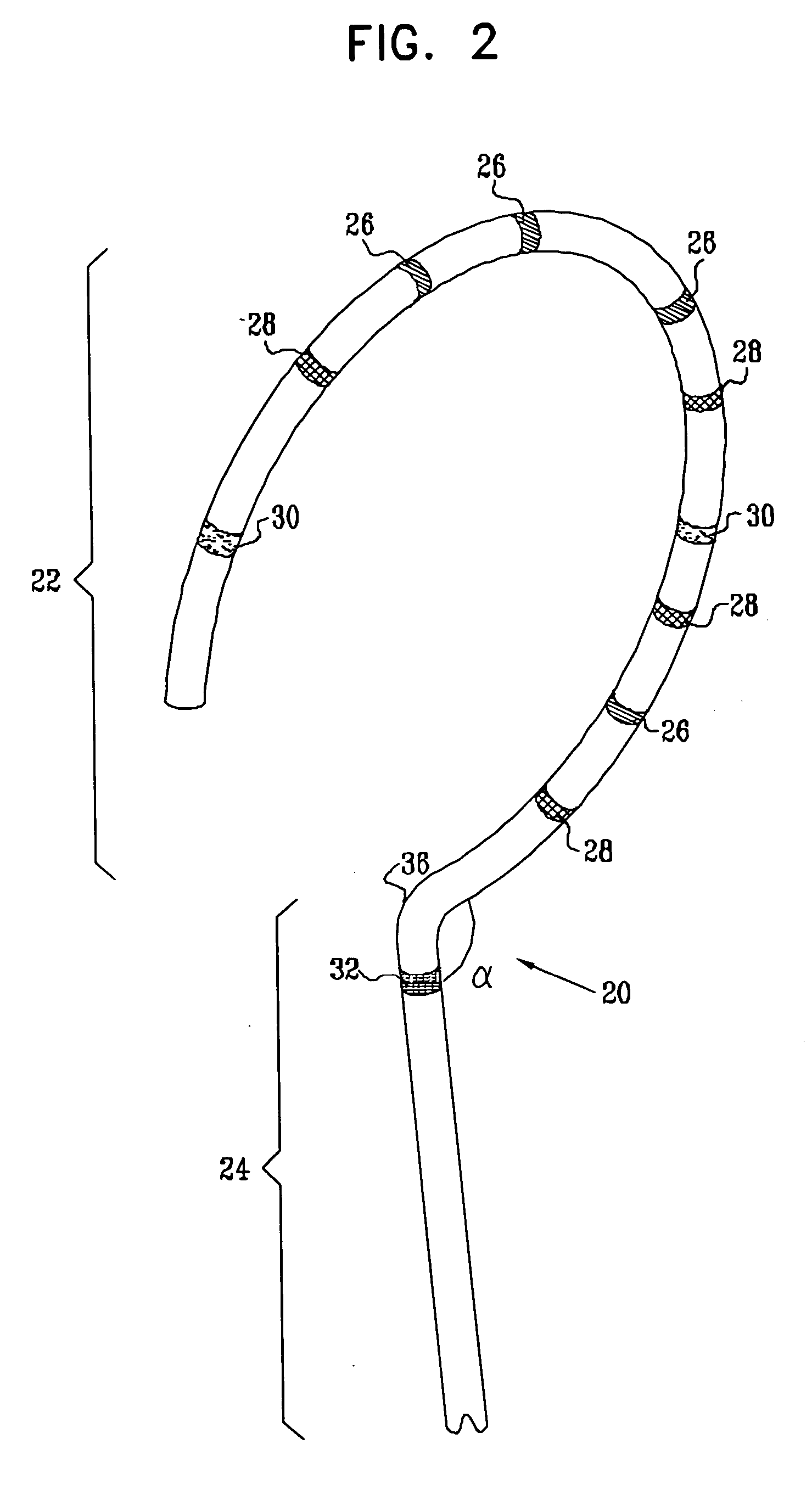 Lasso for pulmonary vein mapping and ablation