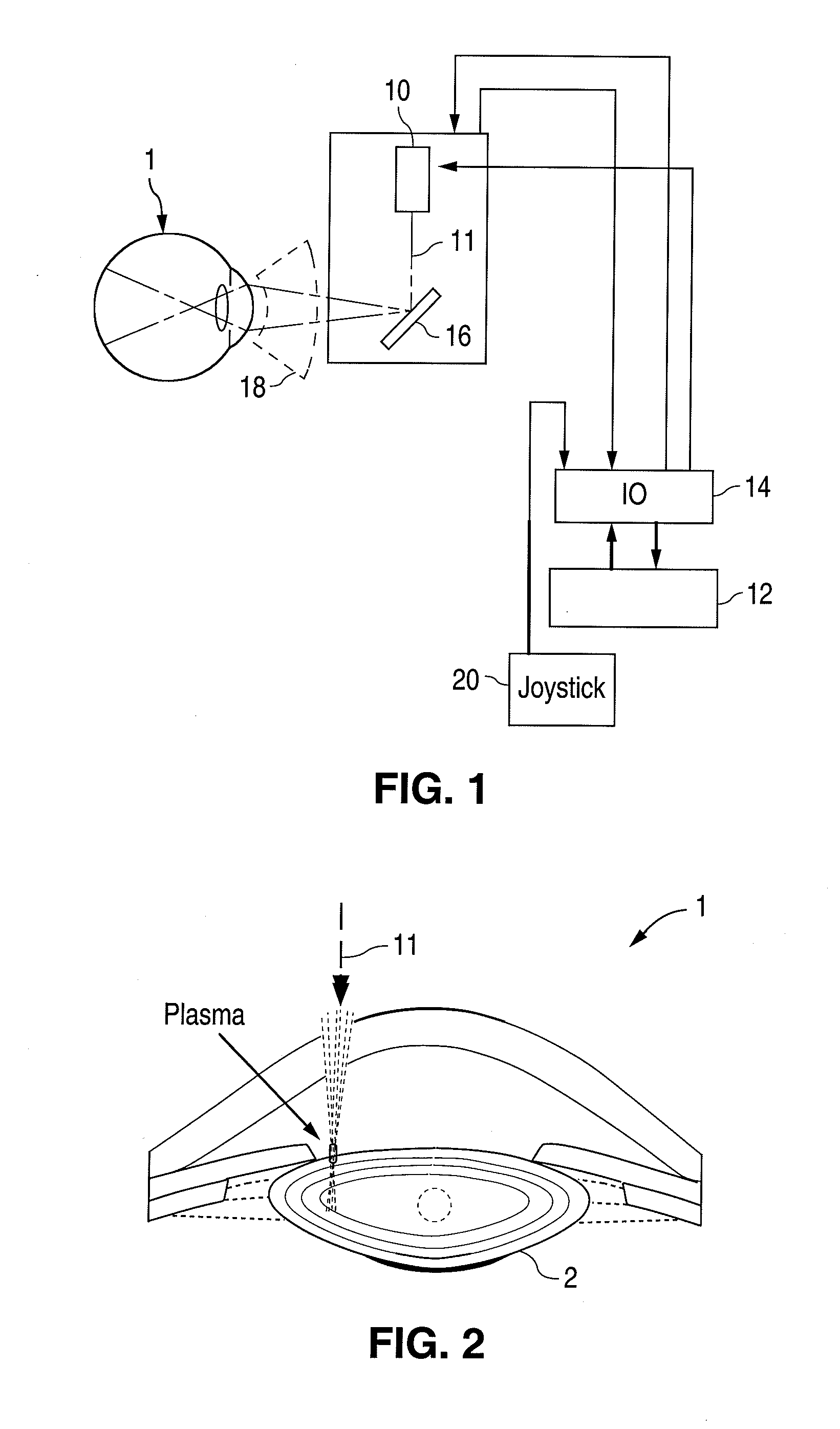 Method and apparatus for patterned plasma-mediated laser trephination of the lens capsule and three dimensional phaco-segmentation