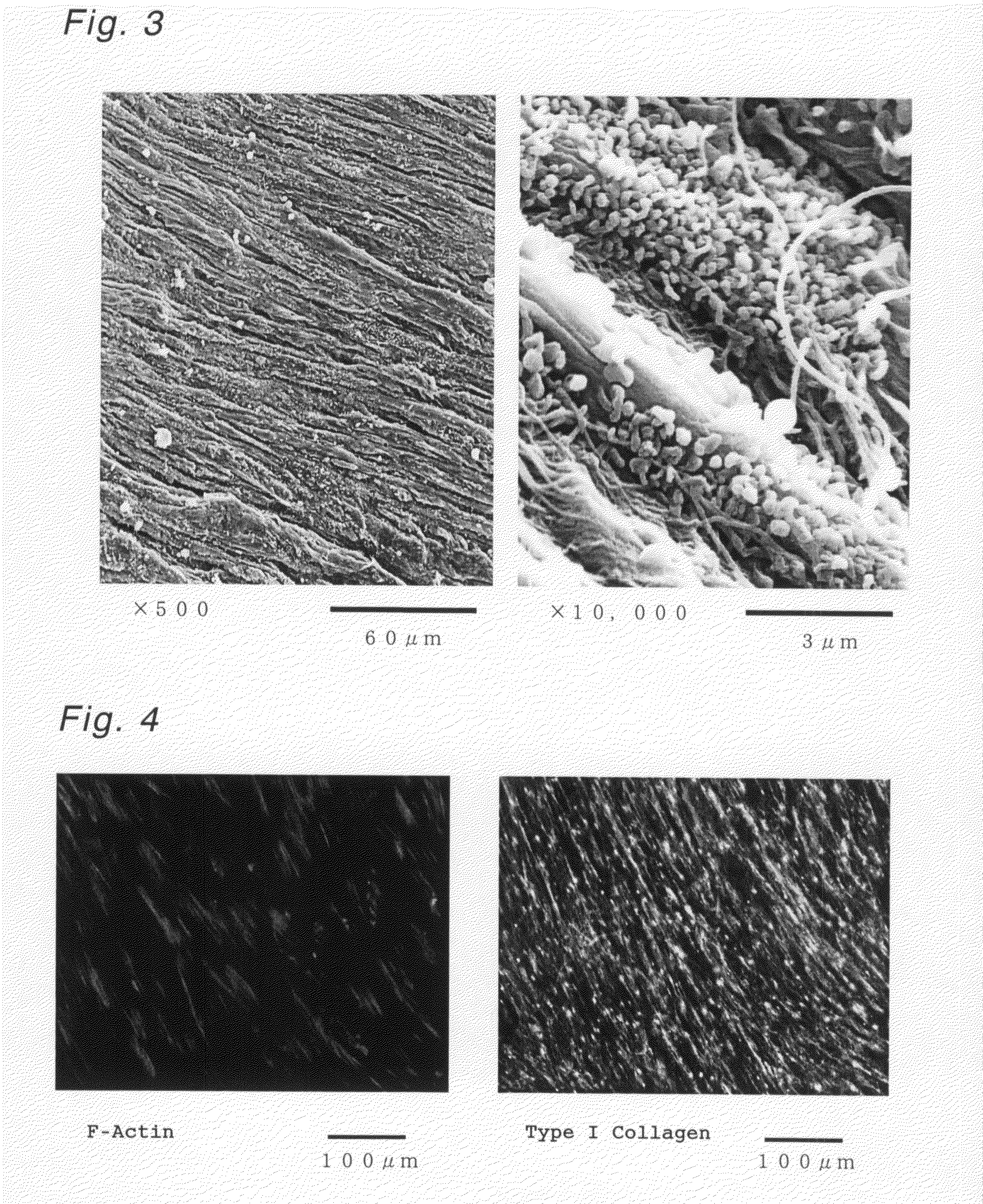 Cultured Periodontal Membrane Cell Sheet, Process for Producing the Same and Method of Use Thereof