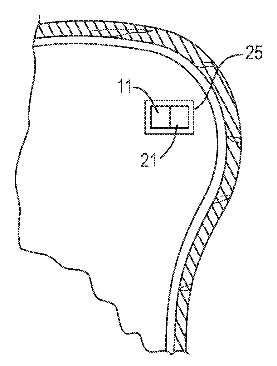 Endoscopic delivery of red/NIR light to the subventricular zone